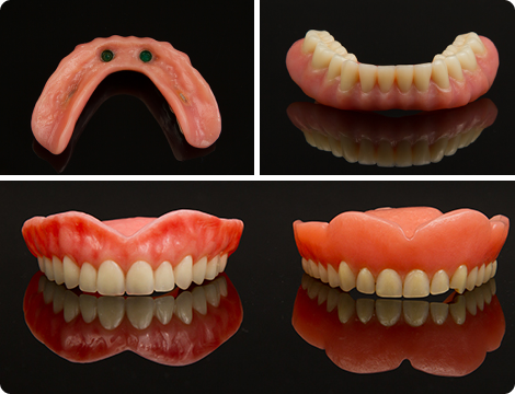 Case 4-Premium Aesthetic