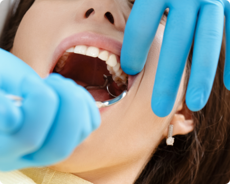 Wisdom Teeth Removal in Melbourne