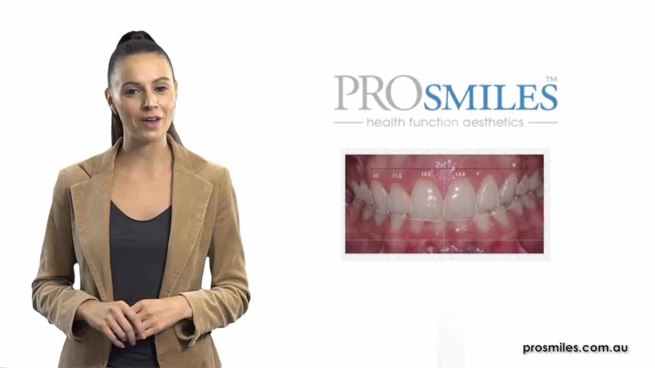 digital smile analysis