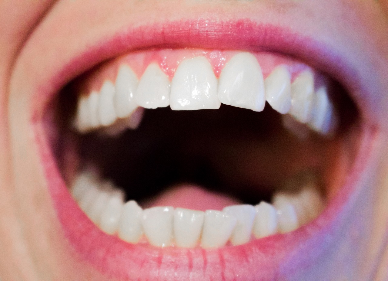 teeth-1652937_1280