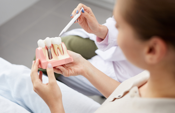 Advantages of Dental Implants