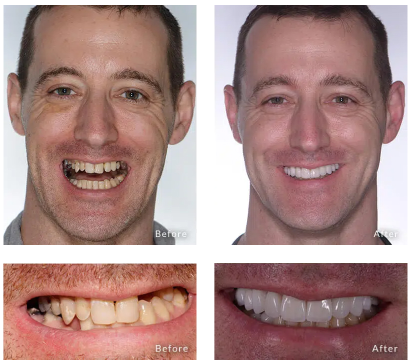 James's Transformation