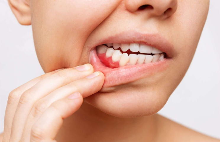 The jawbone