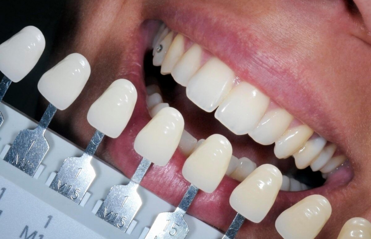 Typical dental emergencies that we see