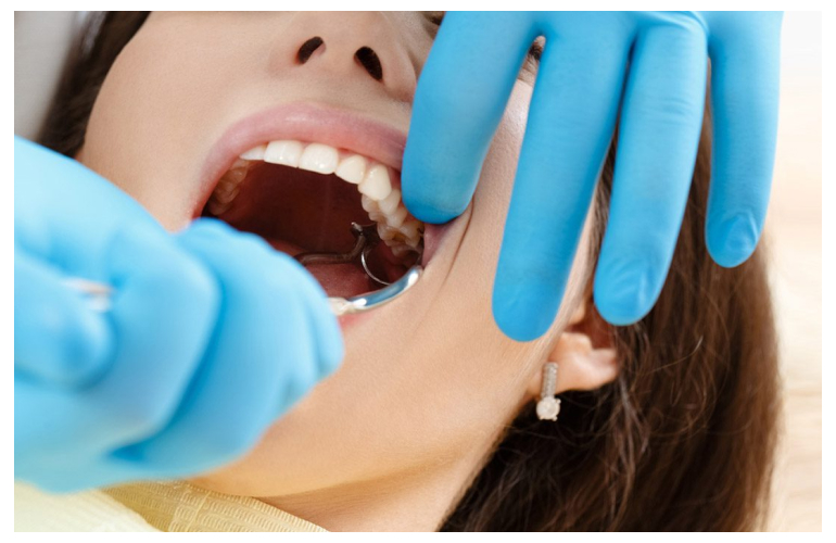 Wisdom teeth removal in Melbourne