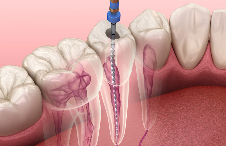 What will I feel if I have an infected tooth?