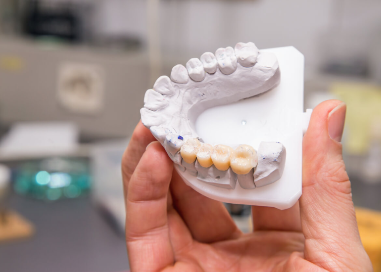 Restoration with Porcelain Crowns