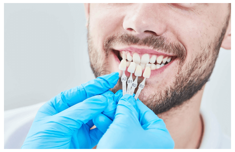 Affordable Dental Implants