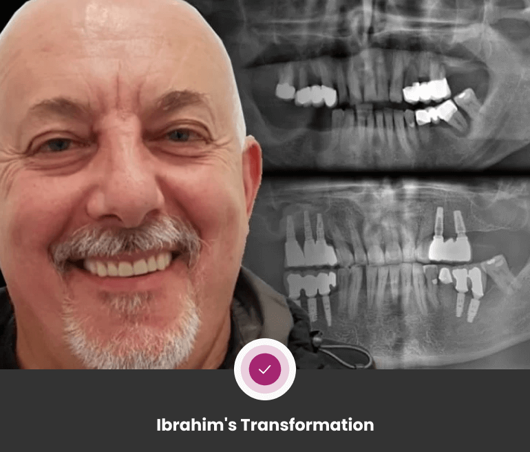 Ibrahim's Transformation