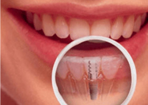 Melbourne’s Preferred Cosmetic Dentist