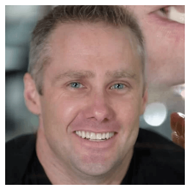 Patient Smile Gallery