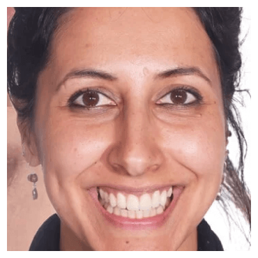 Patient Smile Gallery