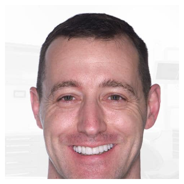 Patient Smile Gallery