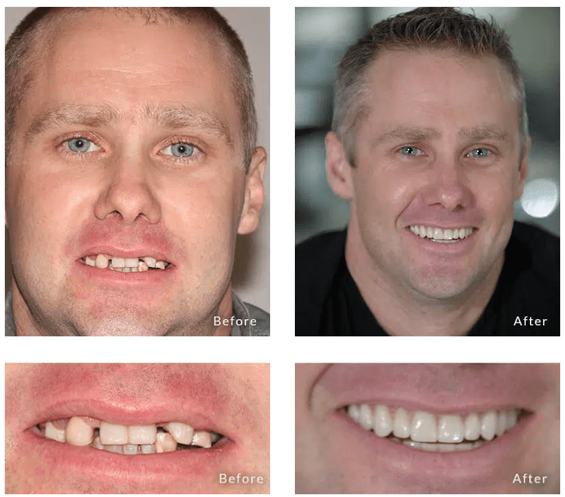 William's Transformation
