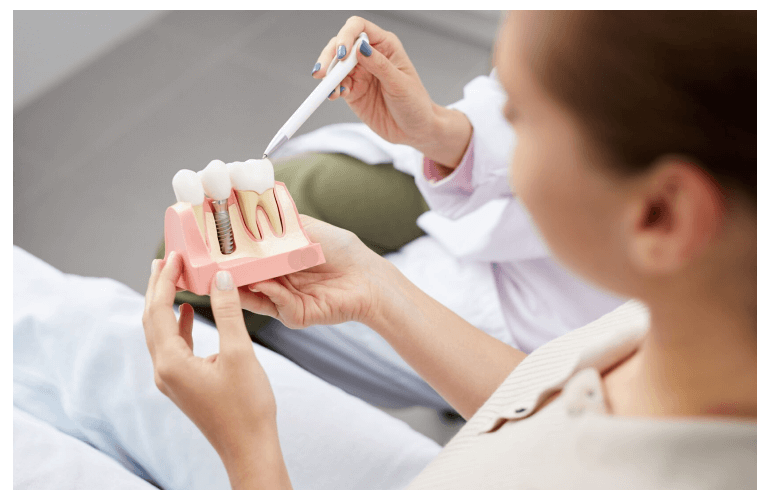 immediate tooth implants