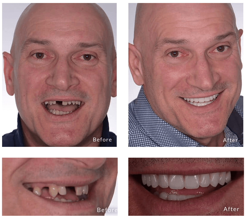 Samuel's Transformation